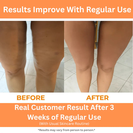EasySculpt™ Deep Tissue Roller