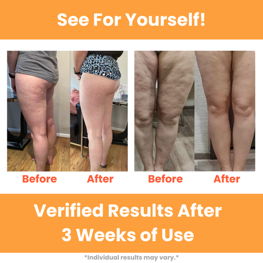 EasySculpt™ Deep Tissue Roller